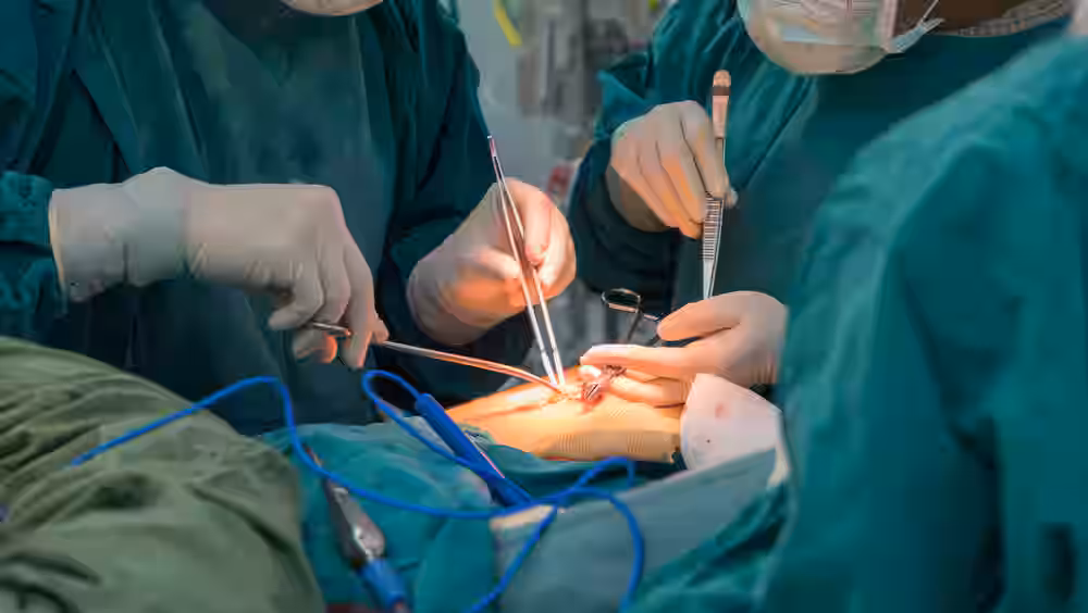 General Surgery