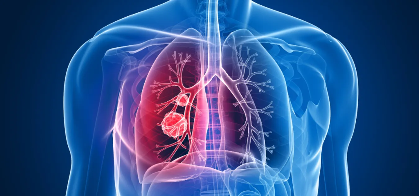 Lung Care Development