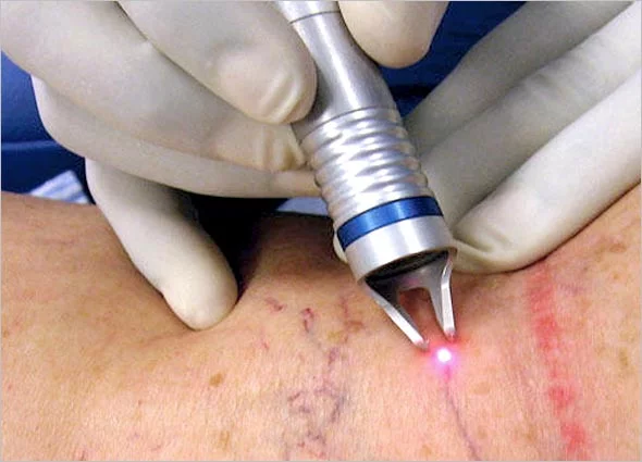 Cardiac and Thoracic Surgery